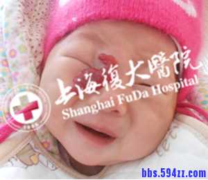 海绵状血管瘤临床表现是什么？